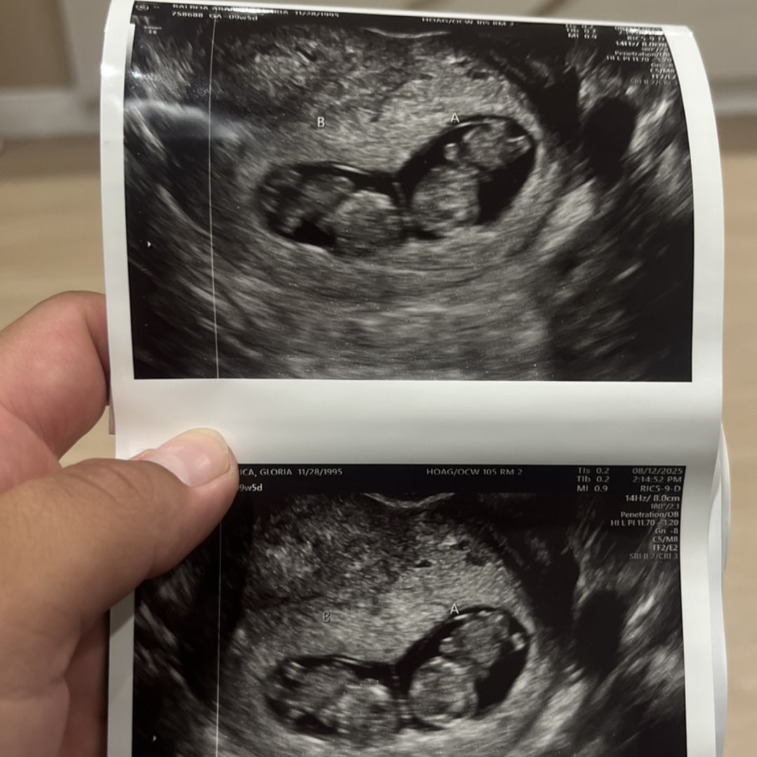 Photo shared by Gloria for their Babylist baby registry.