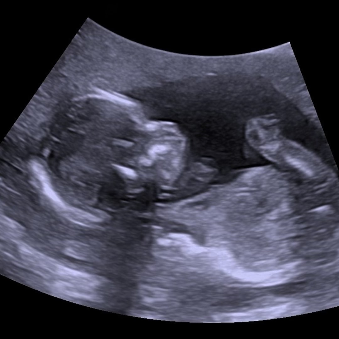Photo shared by Briana for their Babylist baby registry.