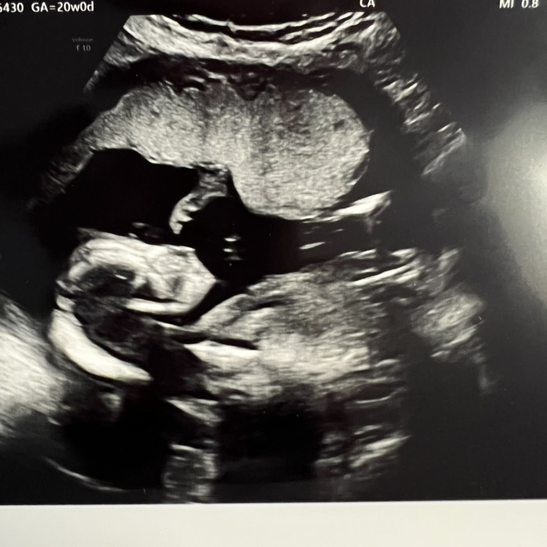 Photo shared by Lauren for their Babylist baby registry.