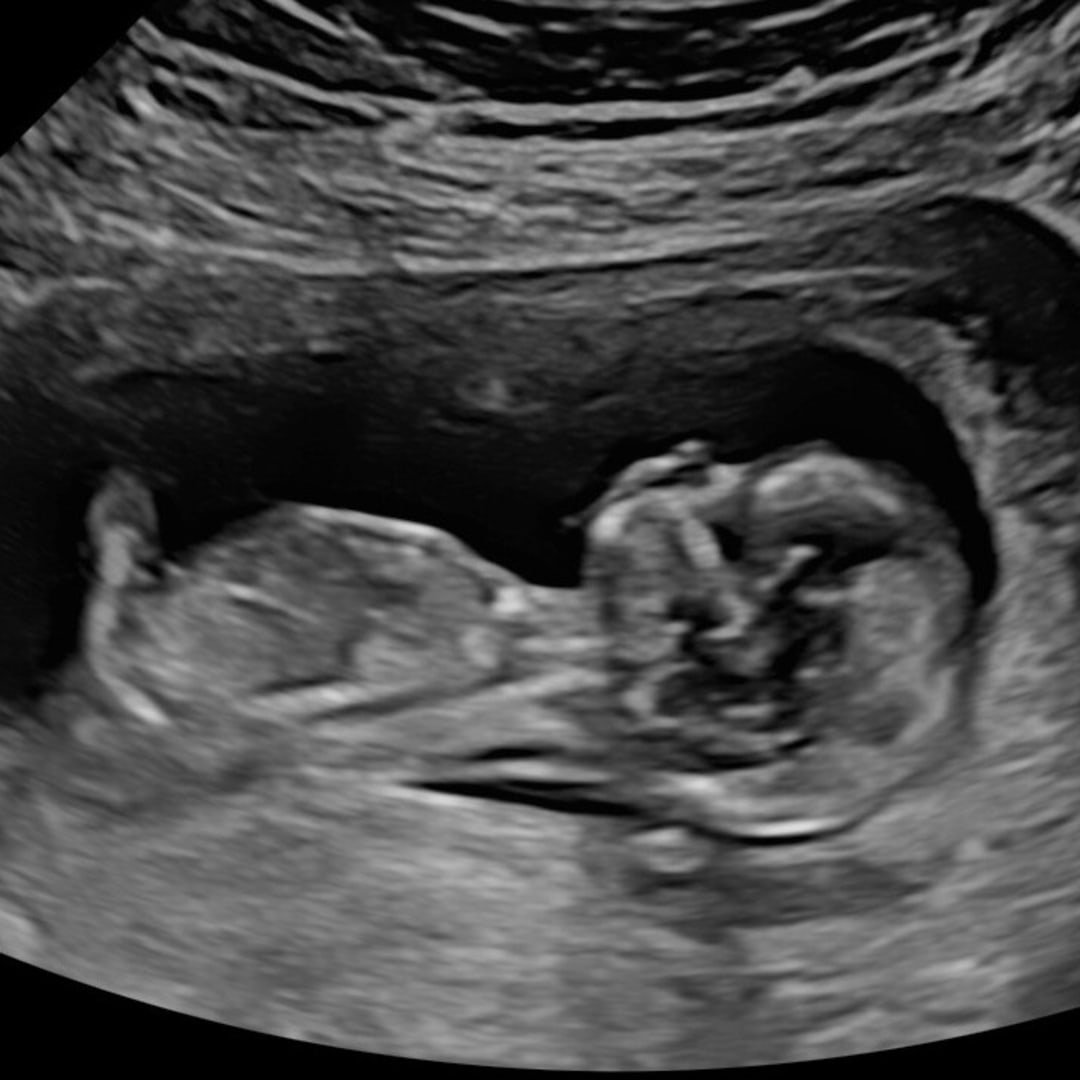 Photo shared by Jaclyn for their Babylist baby registry.