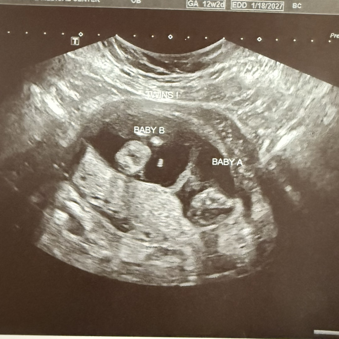 Photo shared by Priscilla for their Babylist baby registry.