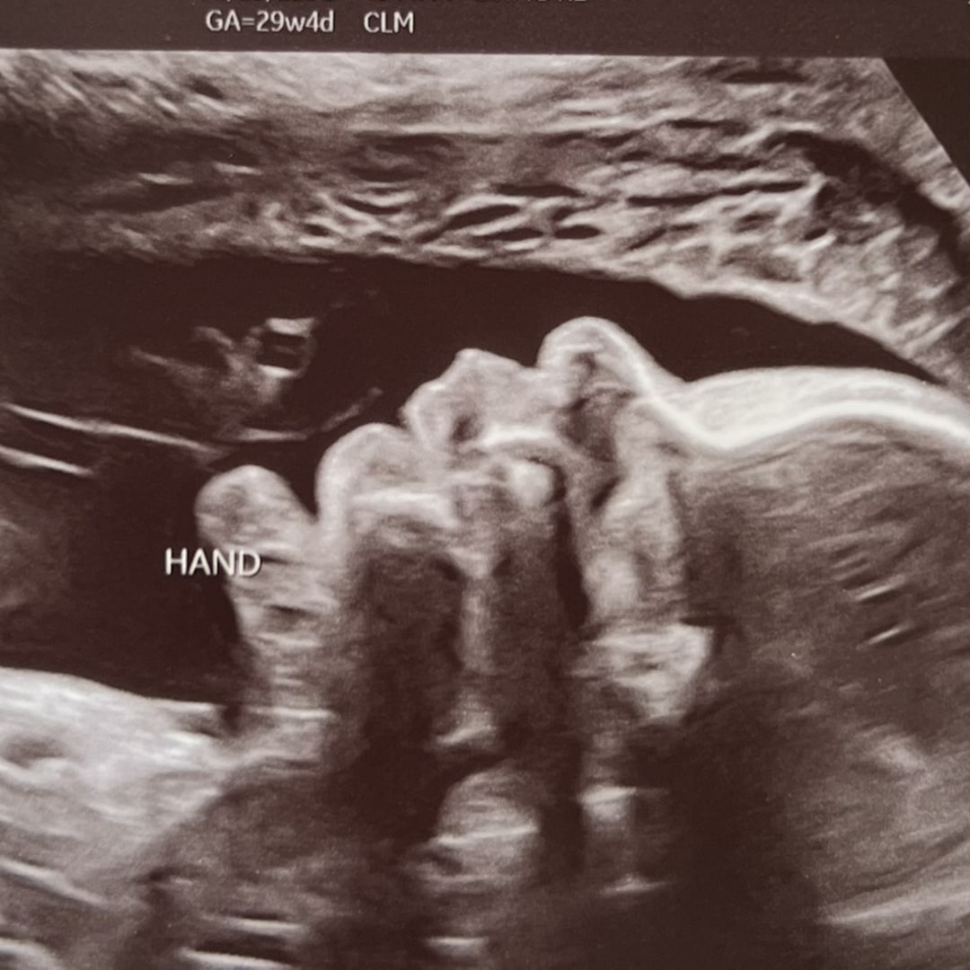 Photo shared by Autumn for their Babylist baby registry.