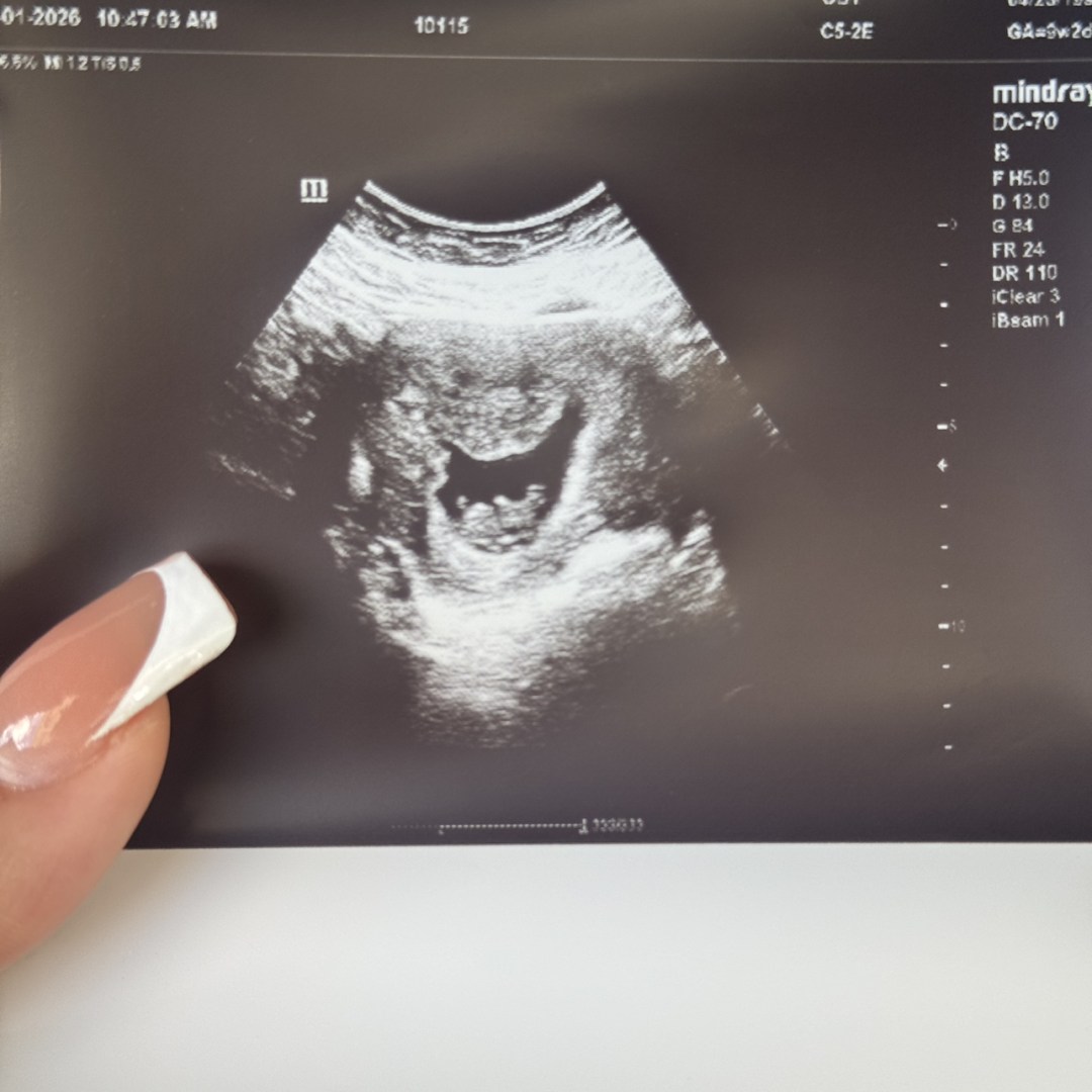 Photo shared by Mari for their Babylist baby registry.