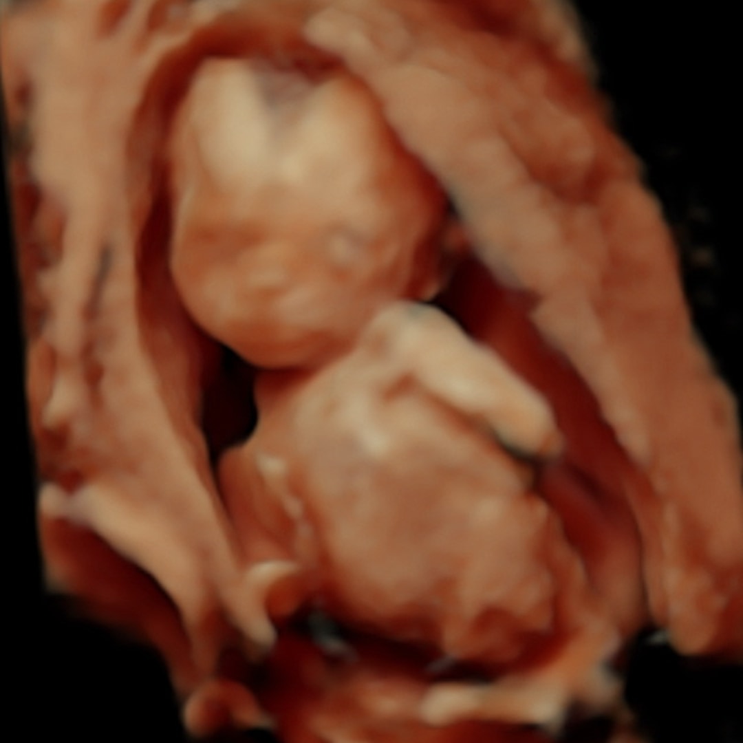 Photo shared by Savannah for their Babylist baby registry.