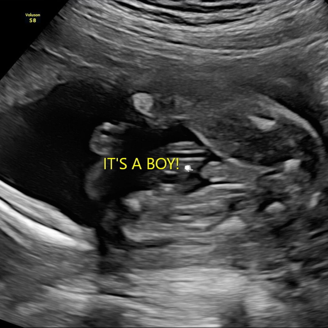 Photo shared by Sandra for their Babylist baby registry.
