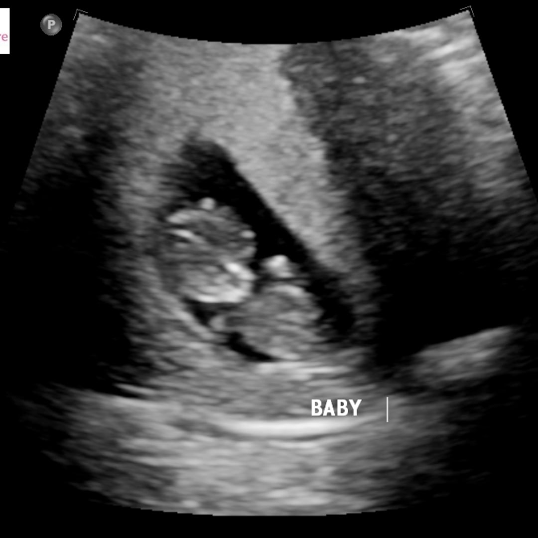 Photo shared by Candis for their Babylist baby registry.