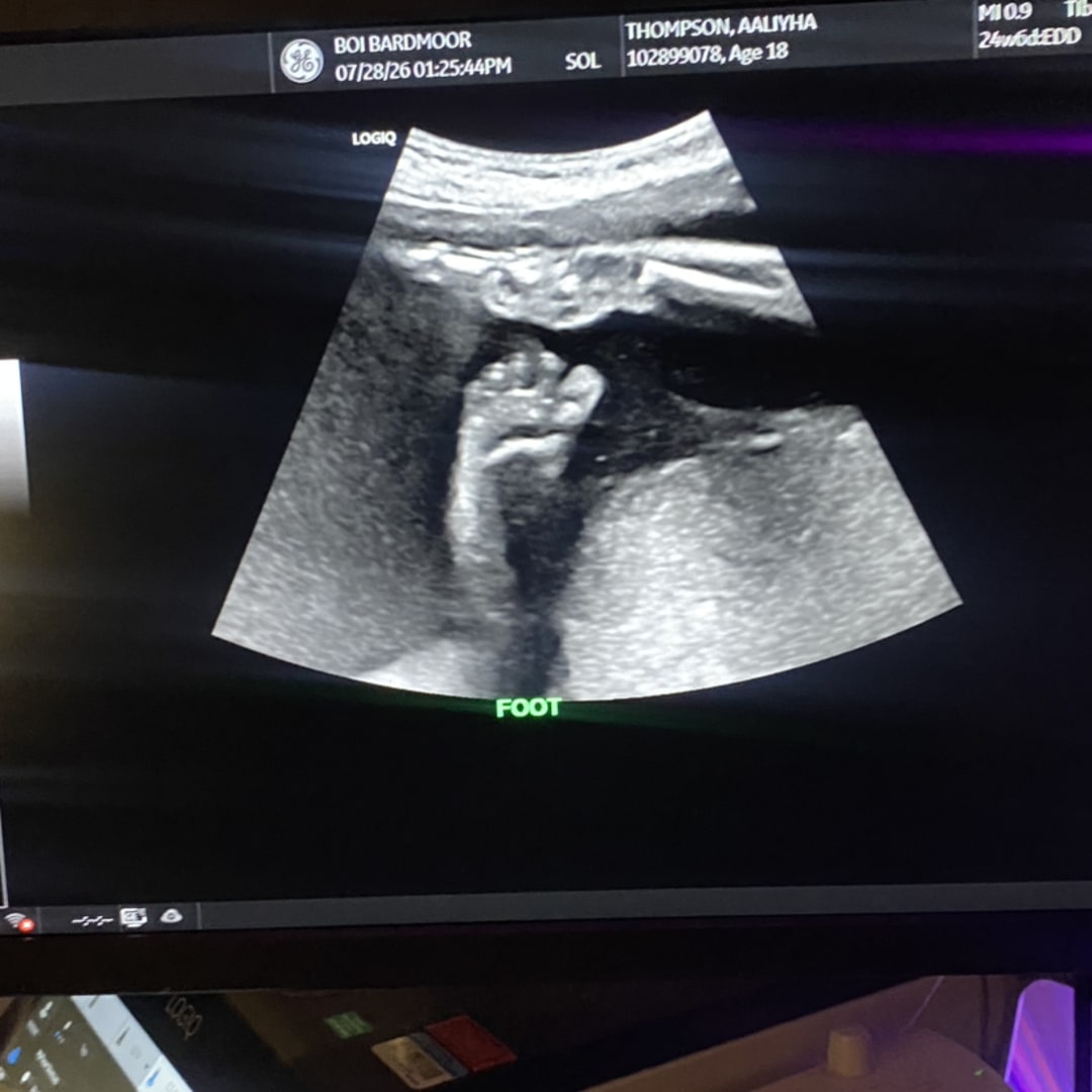 Photo shared by Aaliyha for their Babylist baby registry.