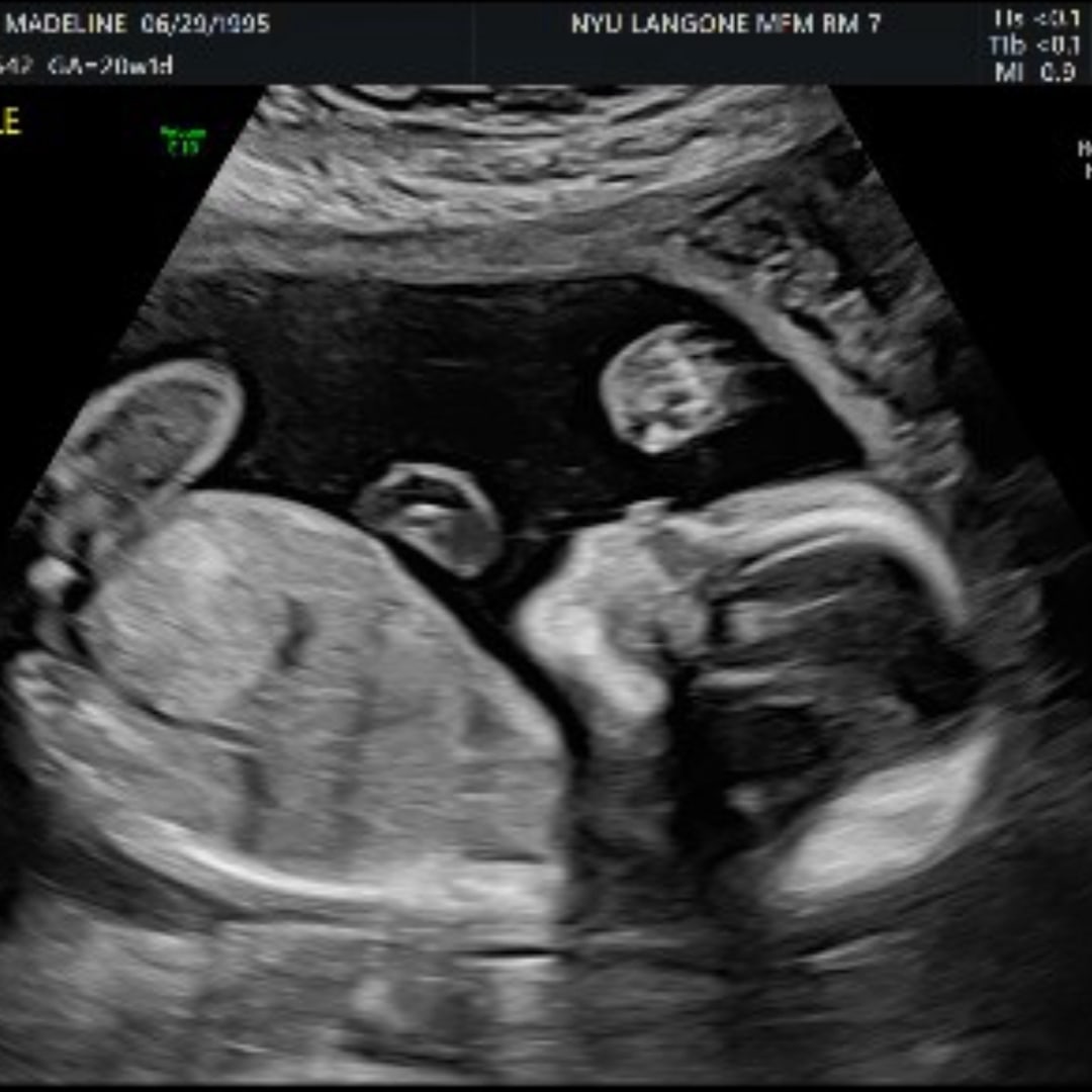 Photo shared by Madeline for their Babylist baby registry.