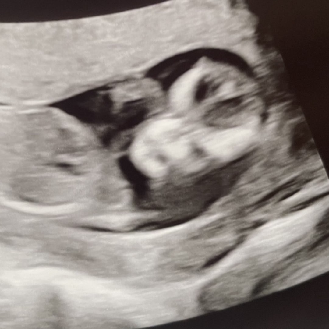 Photo shared by Eden for their Babylist baby registry.