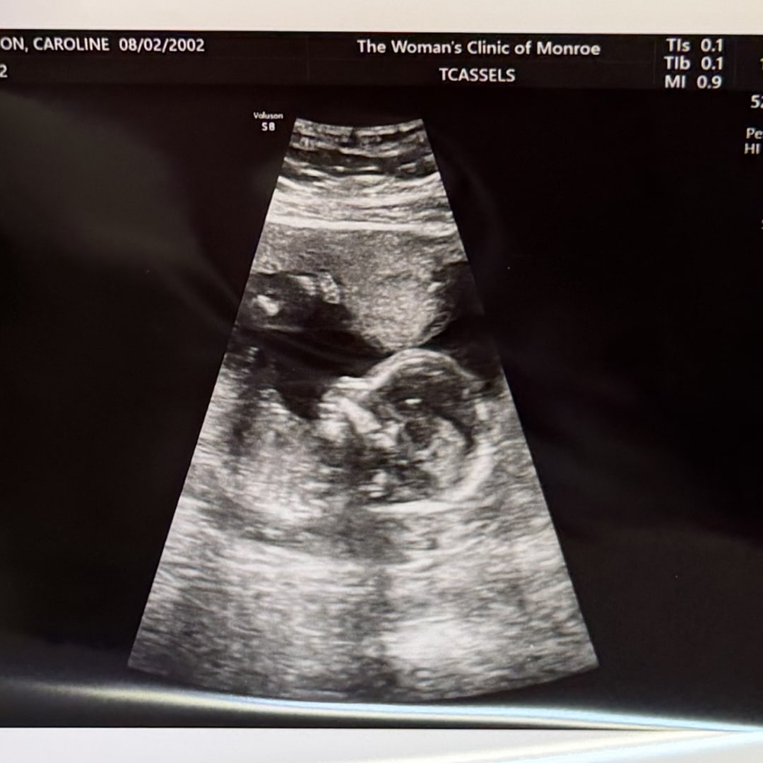 Photo shared by Caroline for their Babylist baby registry.