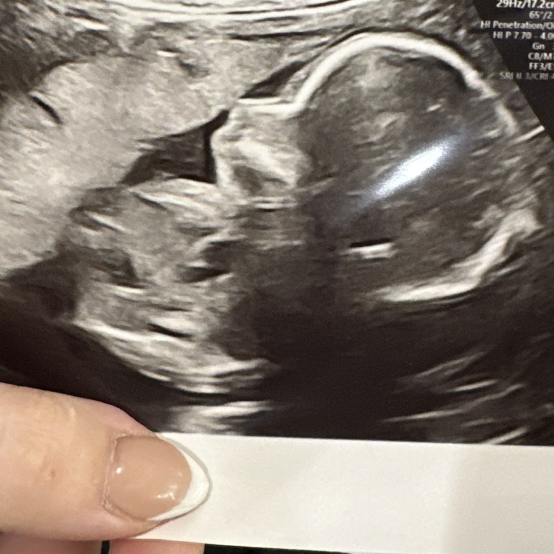 Photo shared by Audrey for their Babylist baby registry.