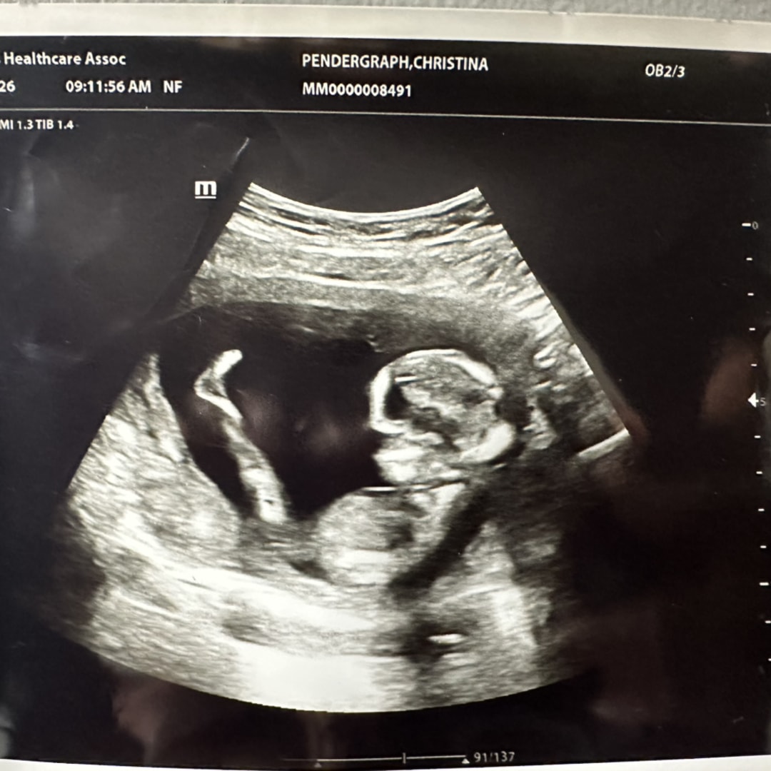 Photo shared by Christina for their Babylist baby registry.