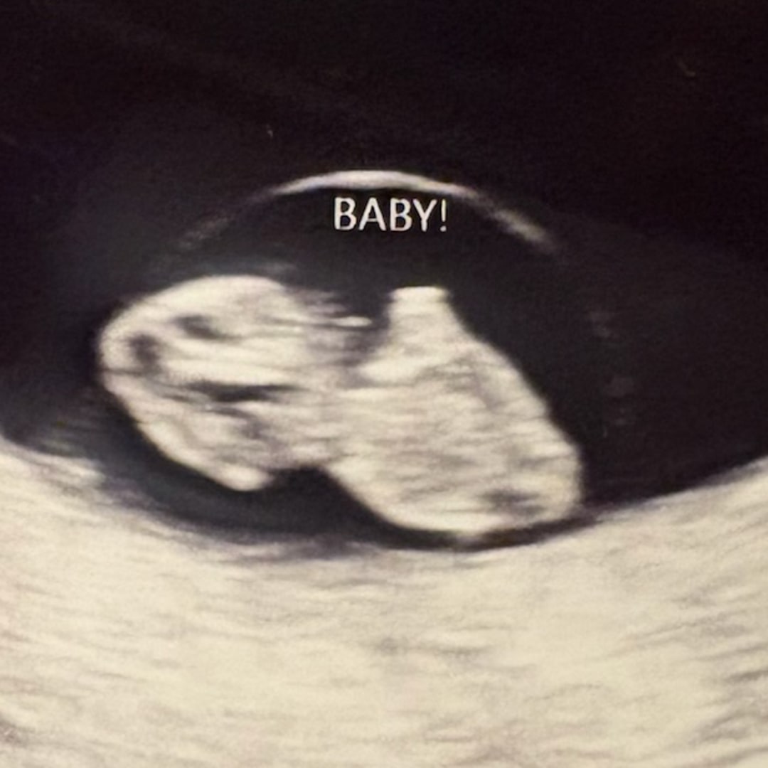 Photo shared by Sharon for their Babylist baby registry.