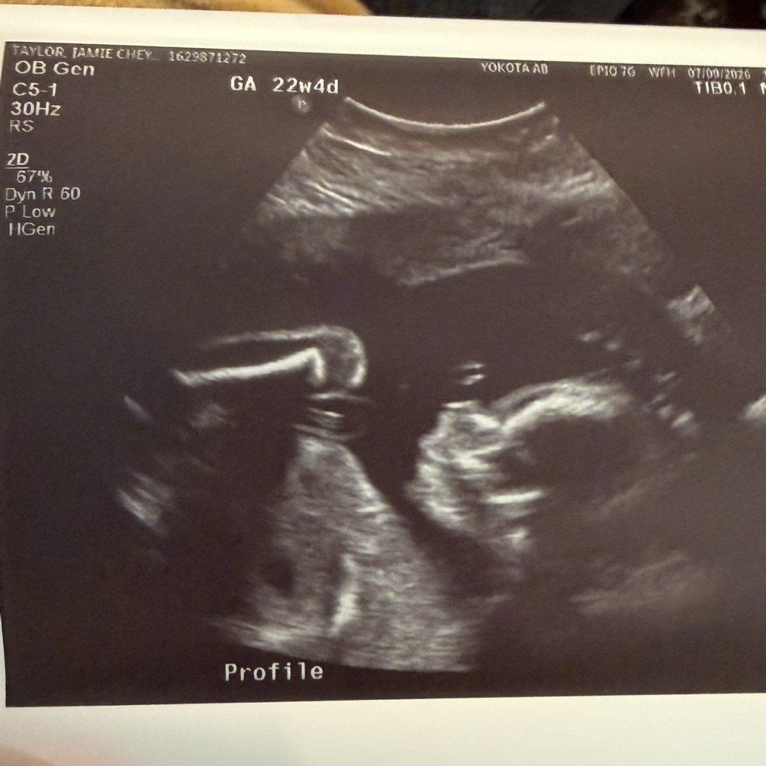 Photo shared by Jamie for their Babylist baby registry.