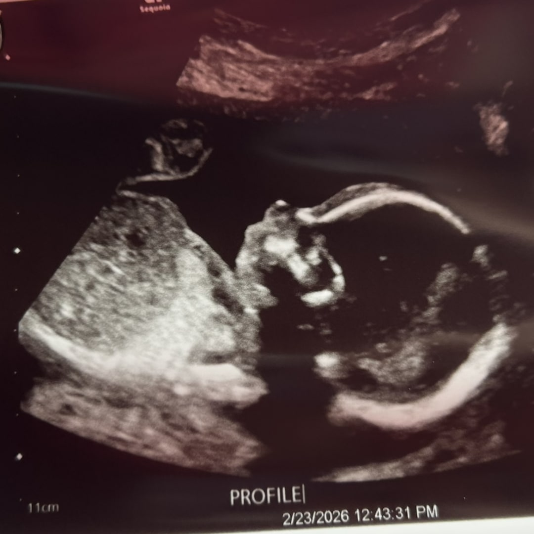 Photo shared by Elli for their Babylist baby registry.