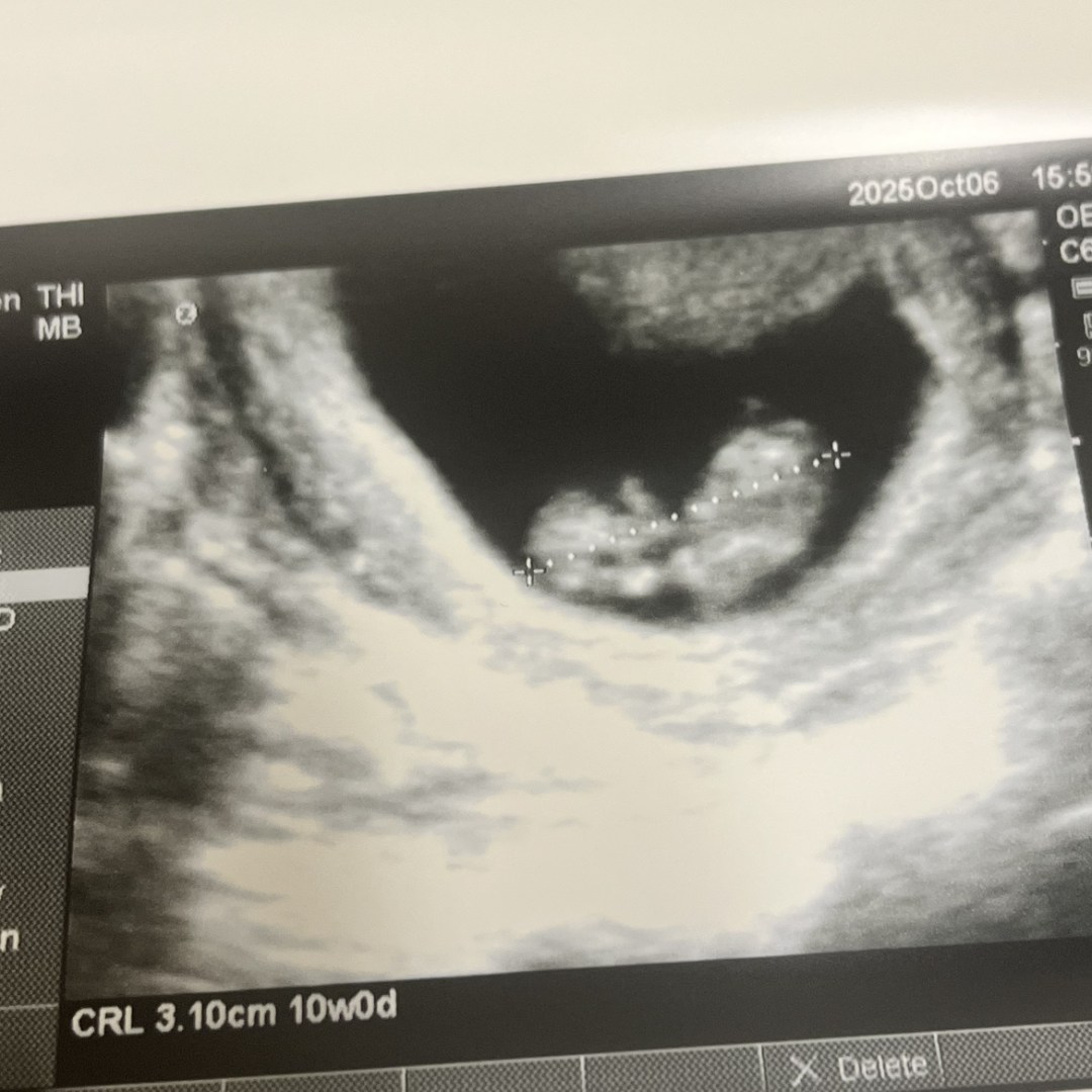 Photo shared by Natasha for their Babylist baby registry.