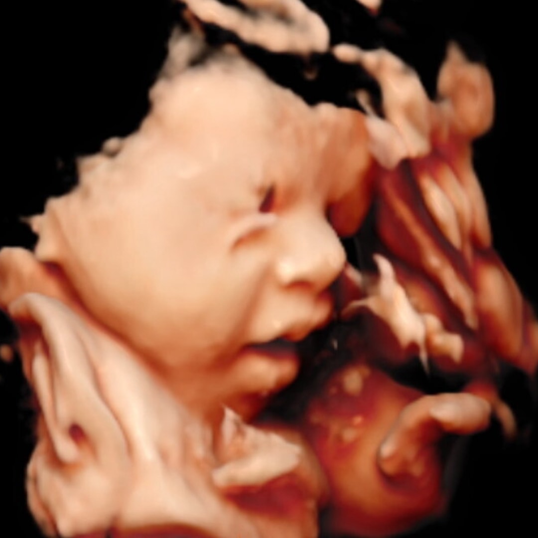 Photo shared by Amanda for their Babylist baby registry.