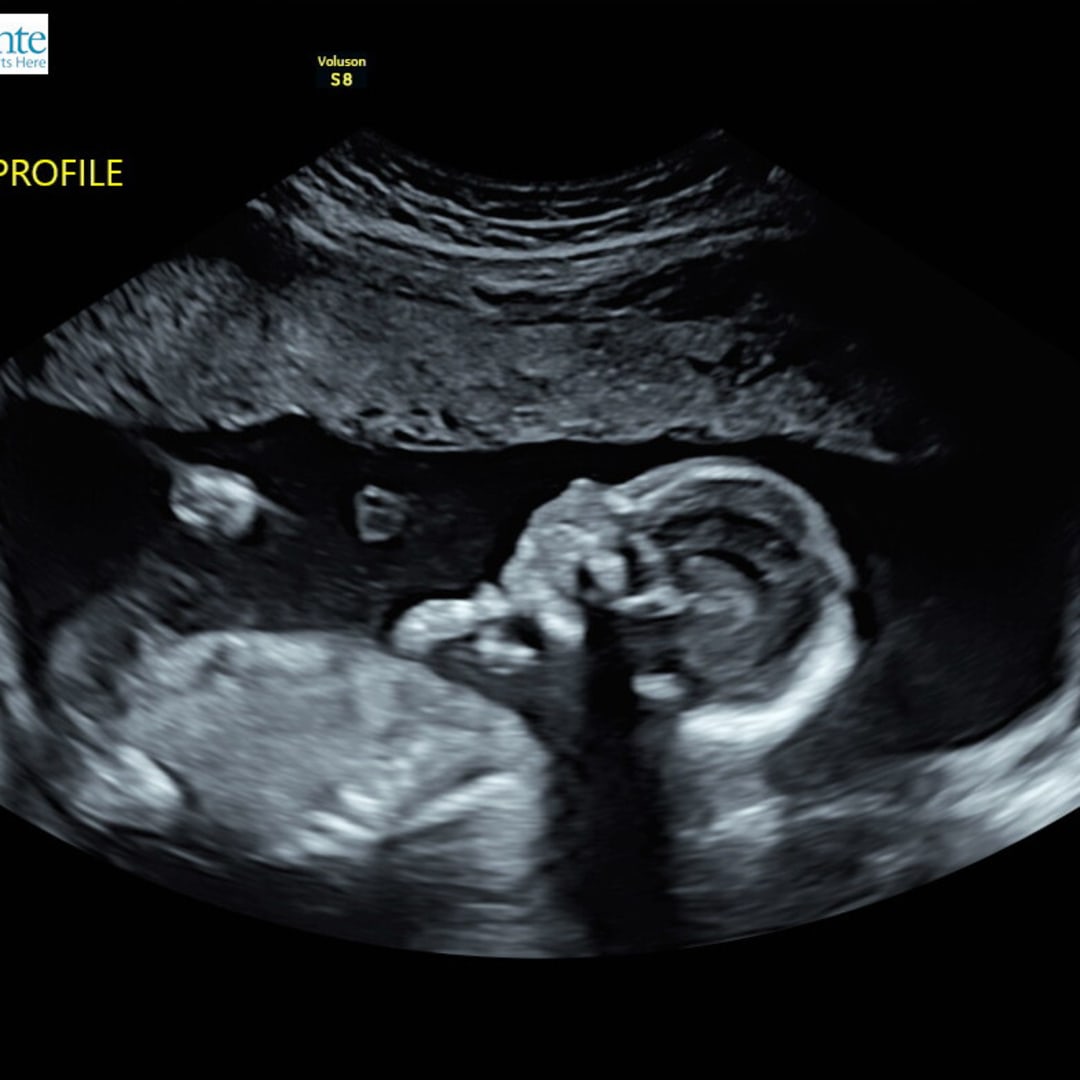 Photo shared by Harley for their Babylist baby registry.