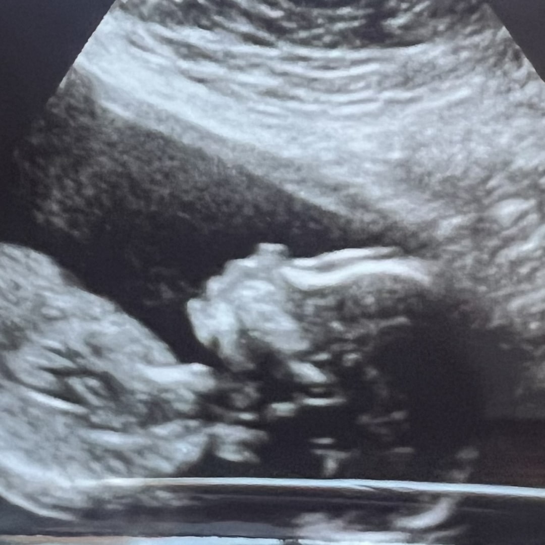 Photo shared by Diana for their Babylist baby registry.