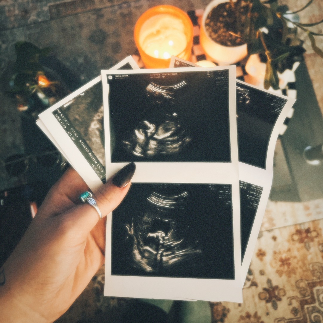 Photo shared by Olivia for their Babylist baby registry.