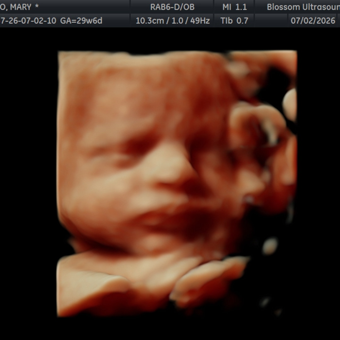 Photo shared by Mary for their Babylist baby registry.