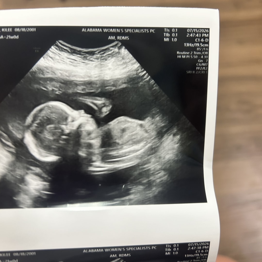 Photo shared by Kilee for their Babylist baby registry.