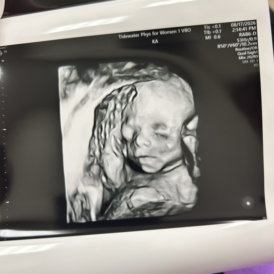 Photo shared by Chelsea for their Babylist baby registry.