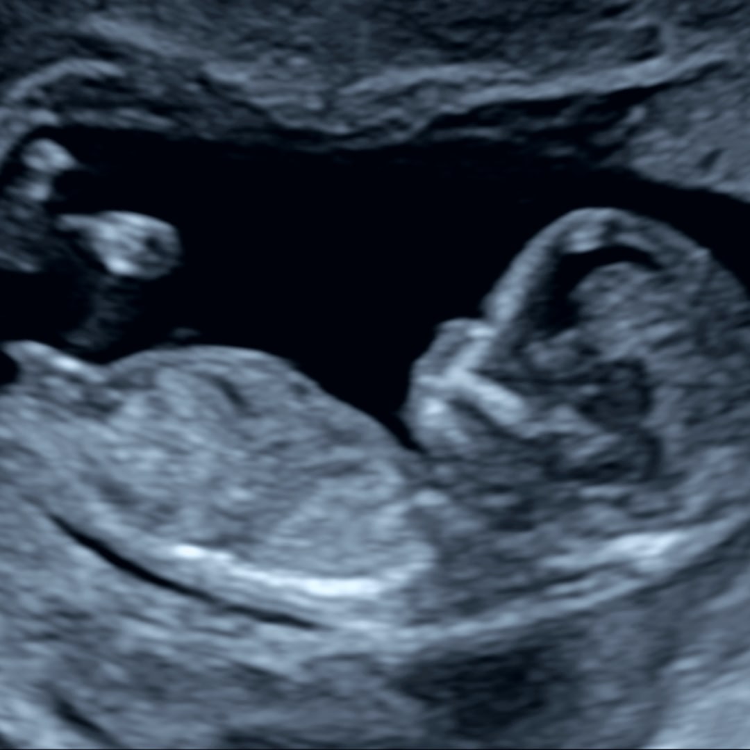 Photo shared by Catherin for their Babylist baby registry.