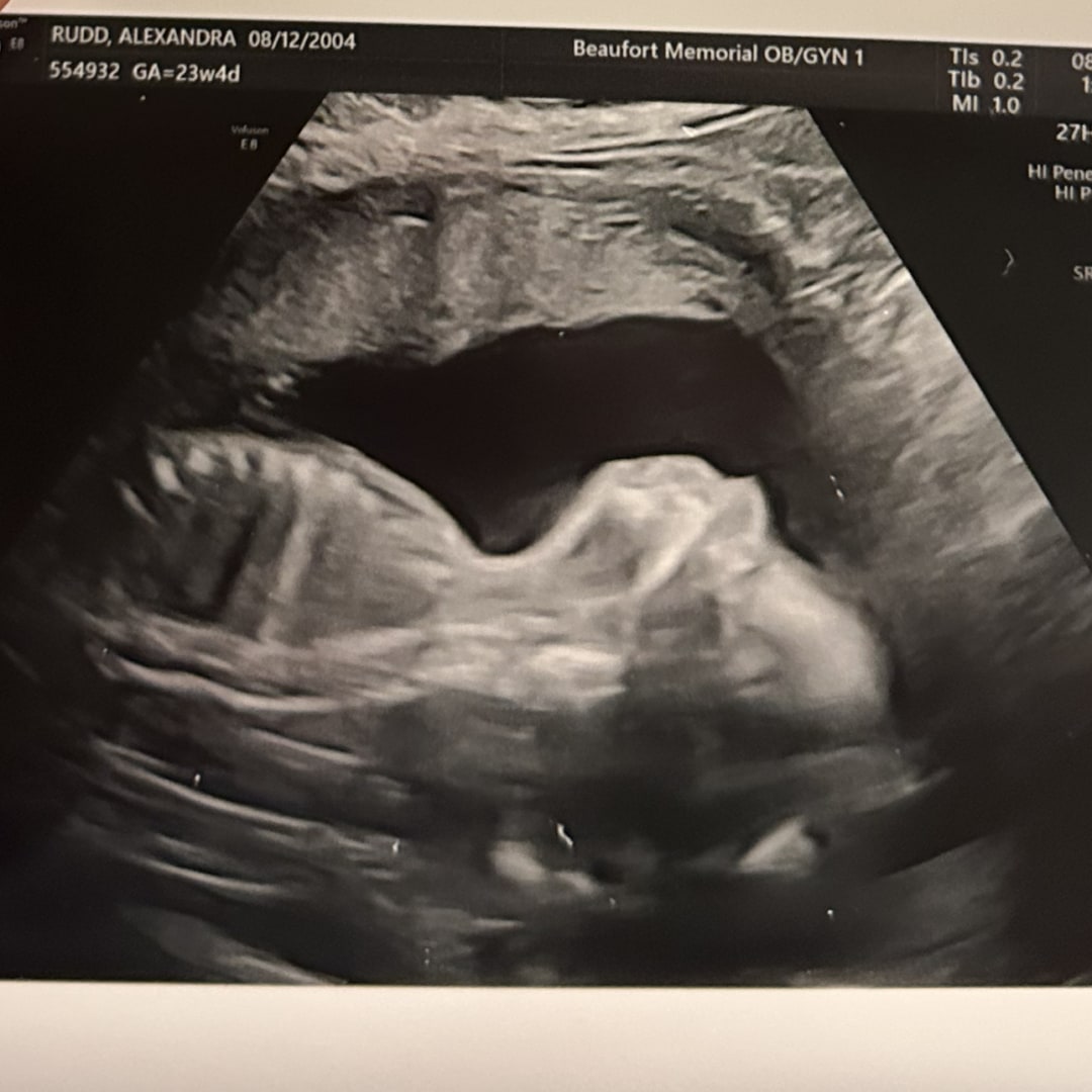 Photo shared by Alexandra for their Babylist baby registry.