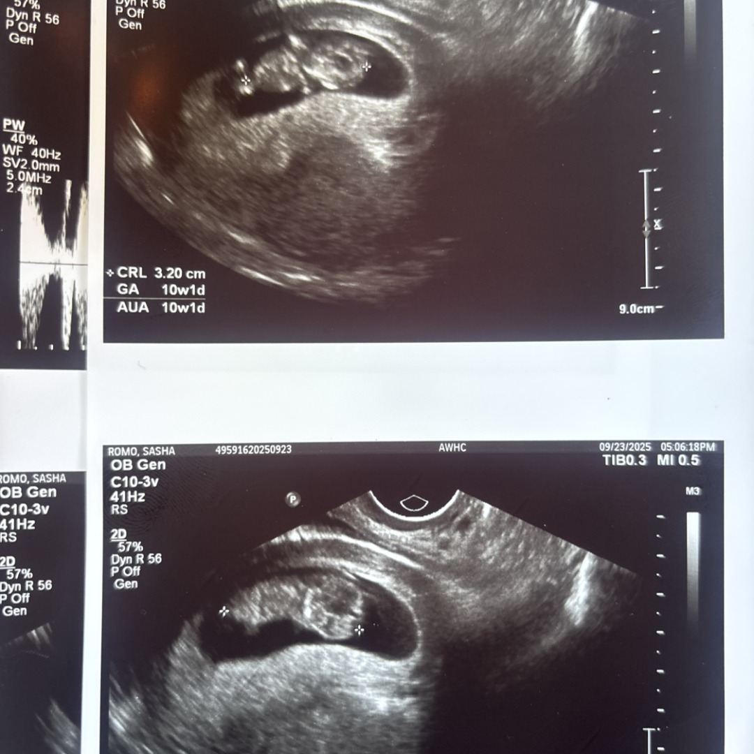 Photo shared by Sasha for their Babylist baby registry.