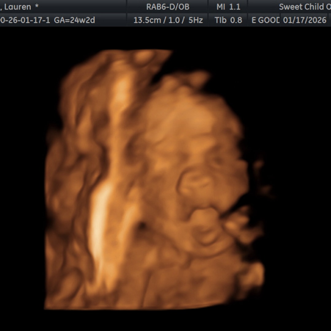 Photo shared by Lauren for their Babylist baby registry.