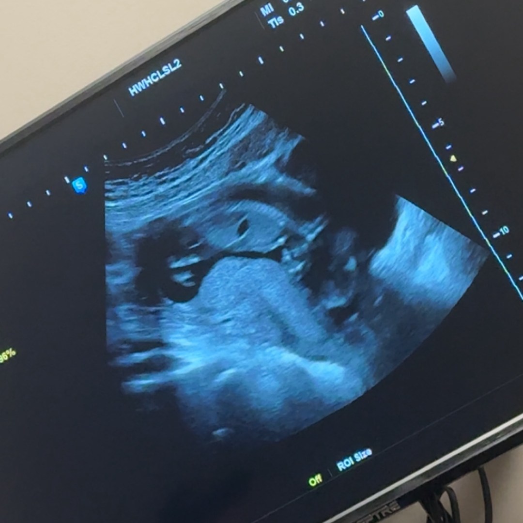 Photo shared by Kate for their Babylist baby registry.