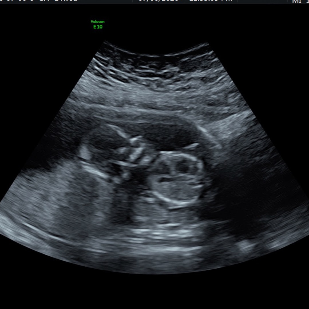 Photo shared by Corrine for their Babylist baby registry.
