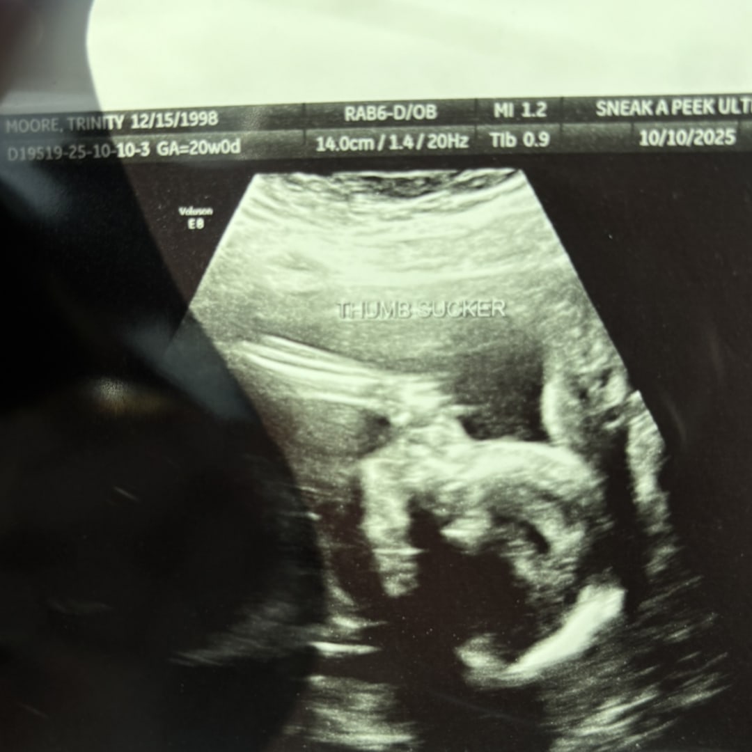 Photo shared by Trinity for their Babylist baby registry.