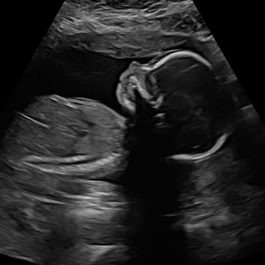 Photo shared by Courtney for their Babylist baby registry.