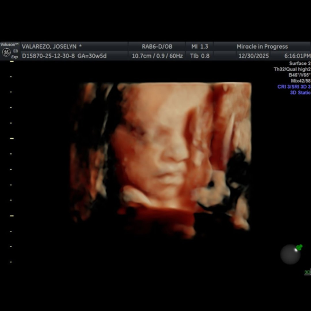 Photo shared by Josey for their Babylist baby registry.