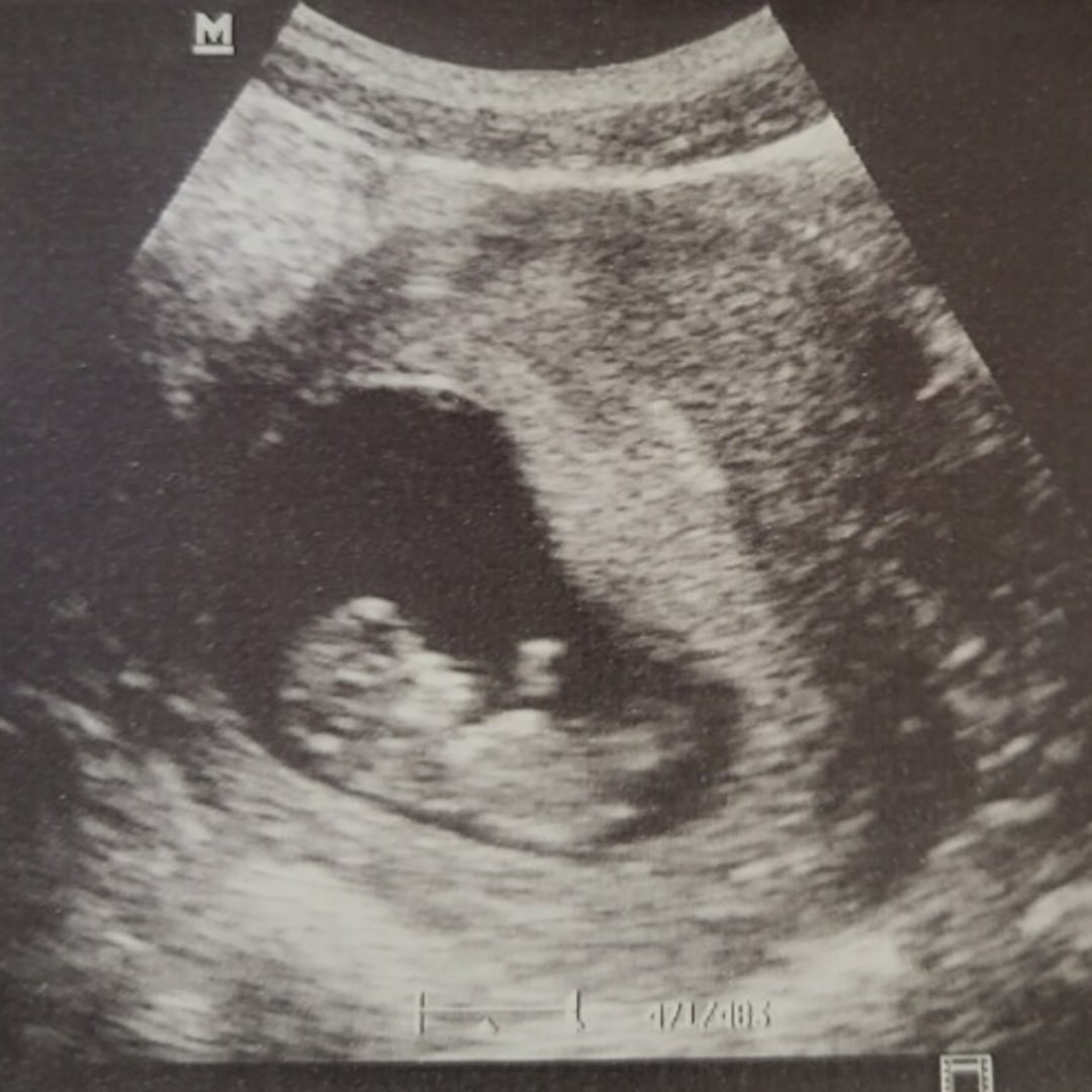 Photo shared by Brittney for their Babylist baby registry.