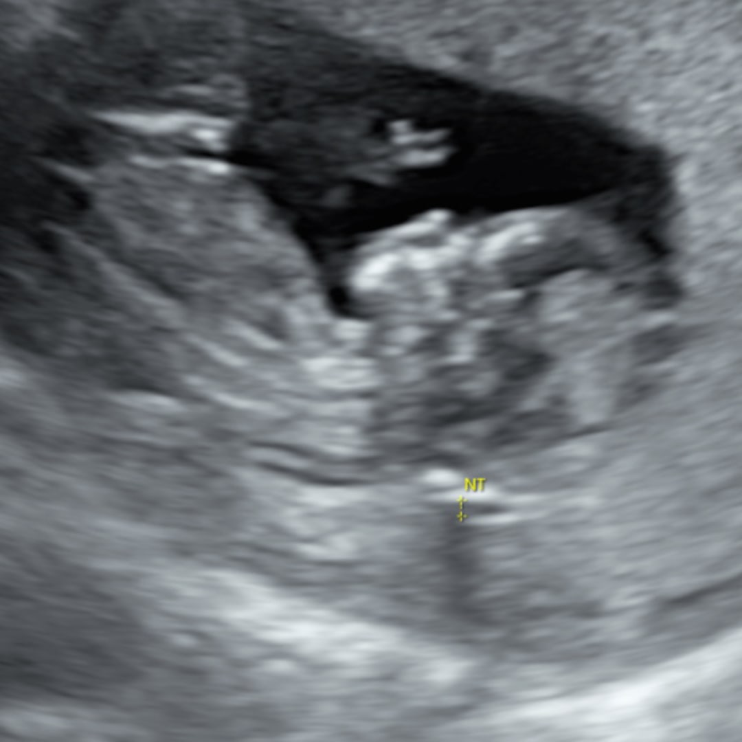 Photo shared by Lillian for their Babylist baby registry.