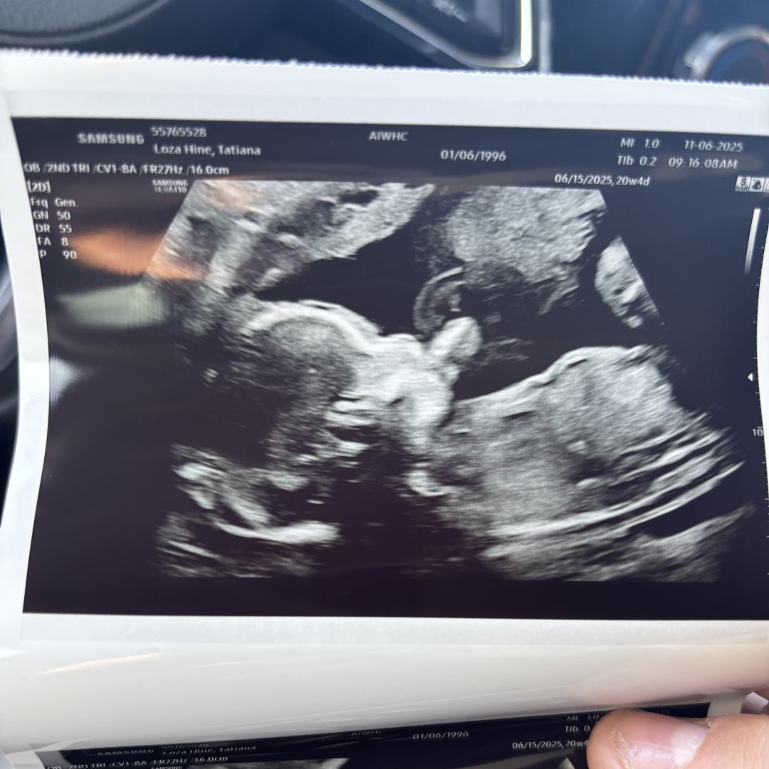 Photo shared by Tatiana for their Babylist baby registry.