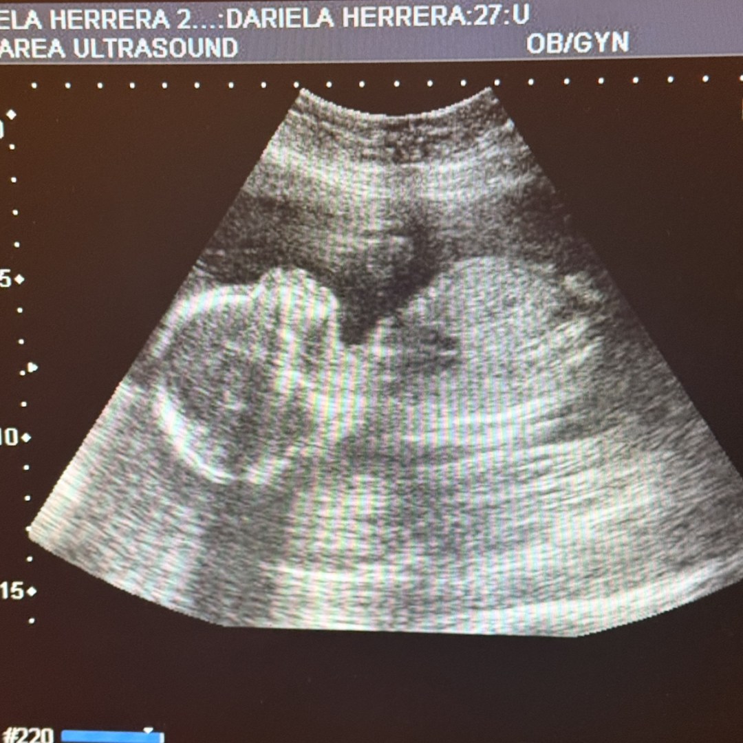 Photo shared by Dariela for their Babylist baby registry.