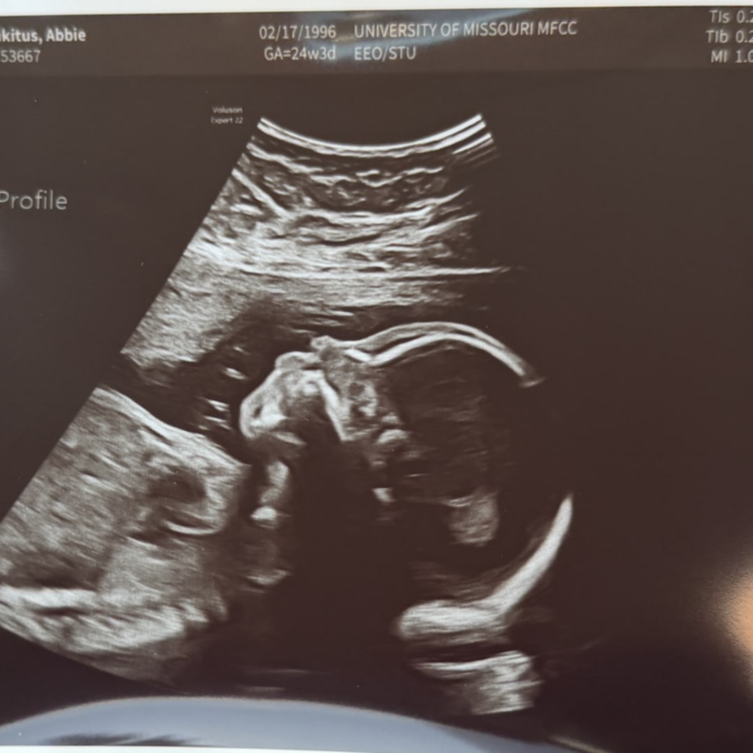 Photo shared by Abbie for their Babylist baby registry.