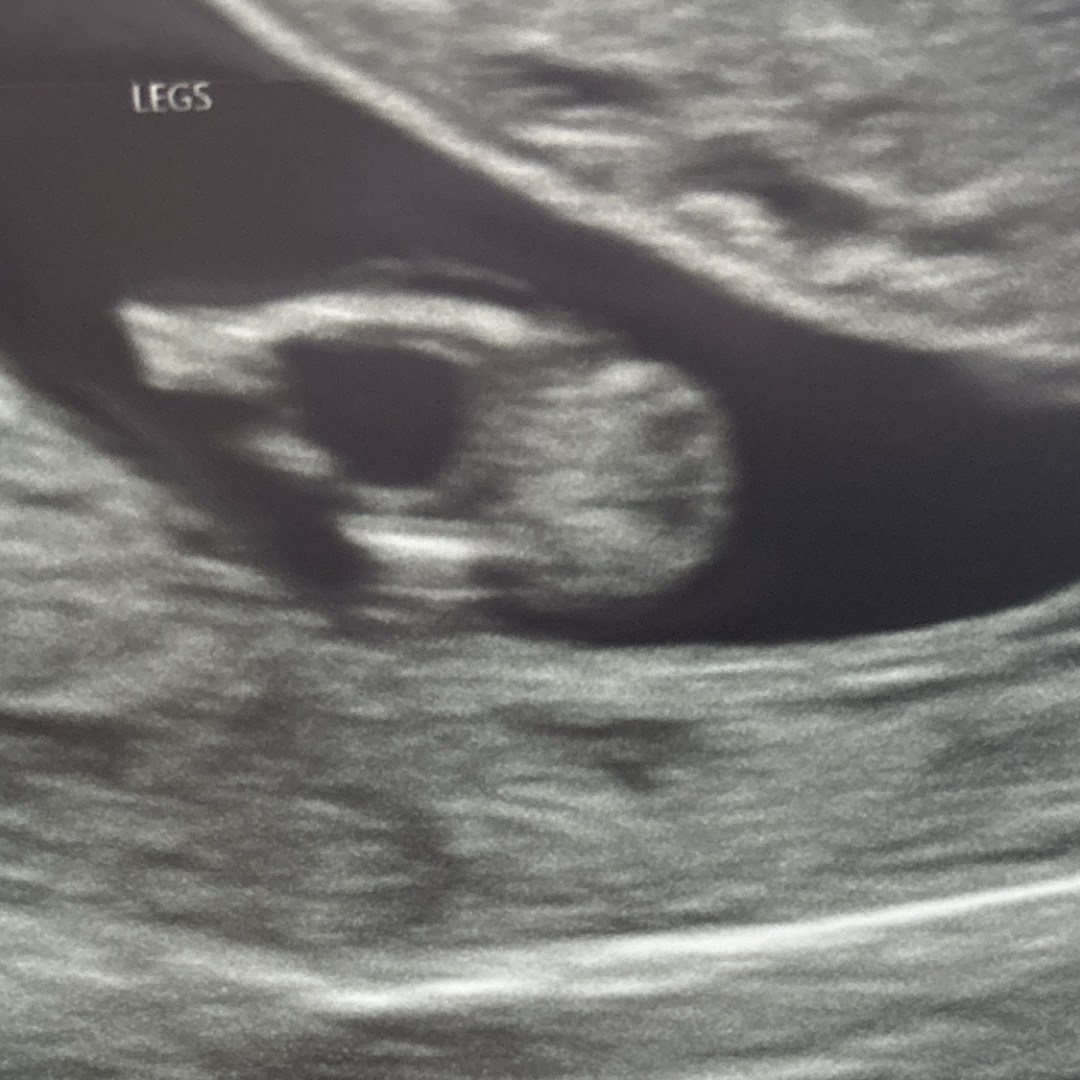 Photo shared by Mersadies for their Babylist baby registry.