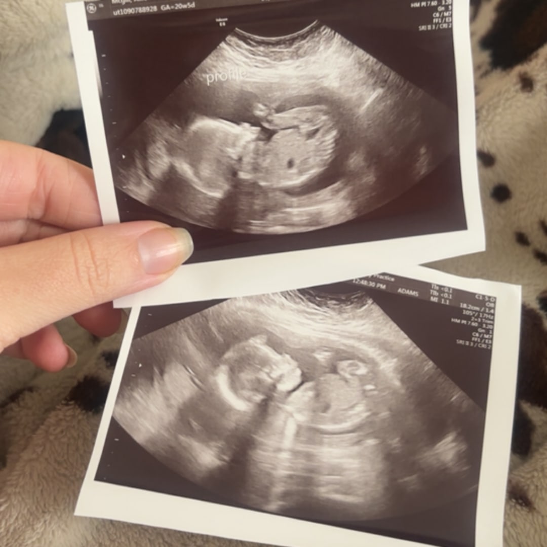 Photo shared by Allie for their Babylist baby registry.