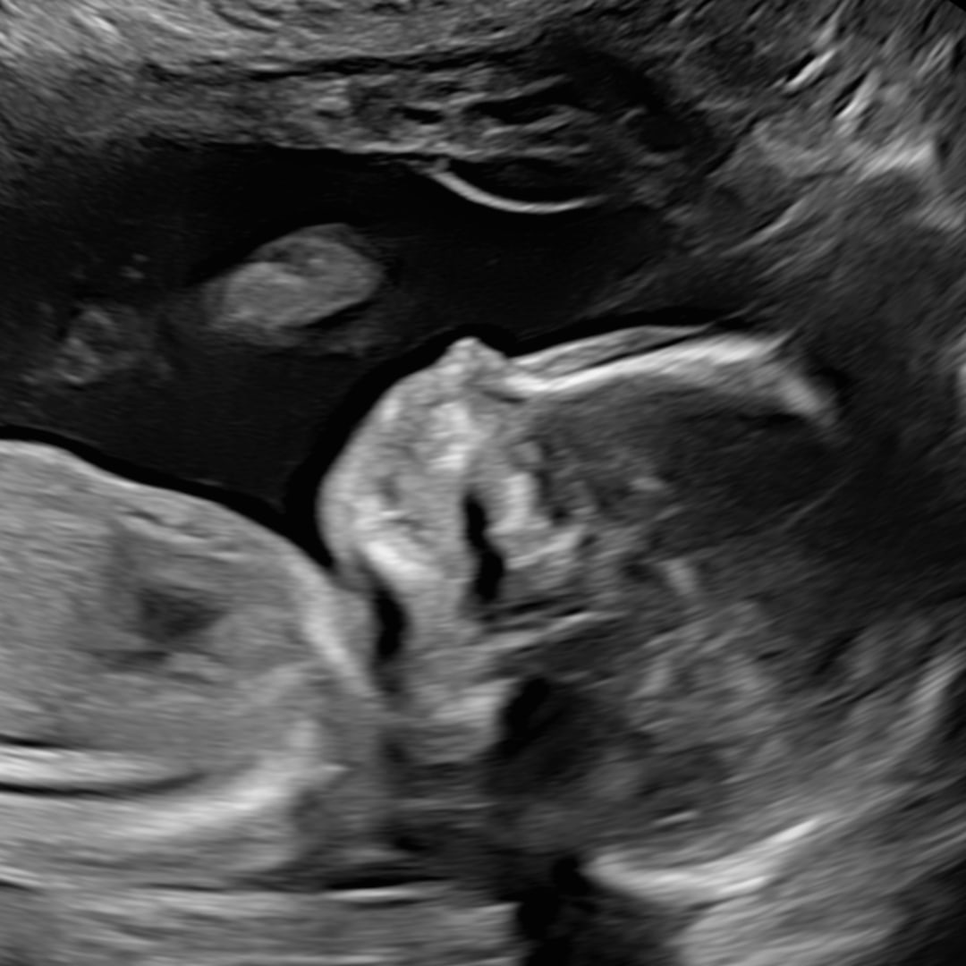 Photo shared by Emily for their Babylist baby registry.