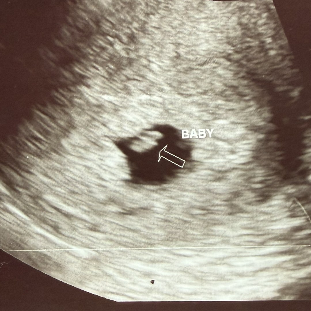 Photo shared by Baileigh for their Babylist baby registry.