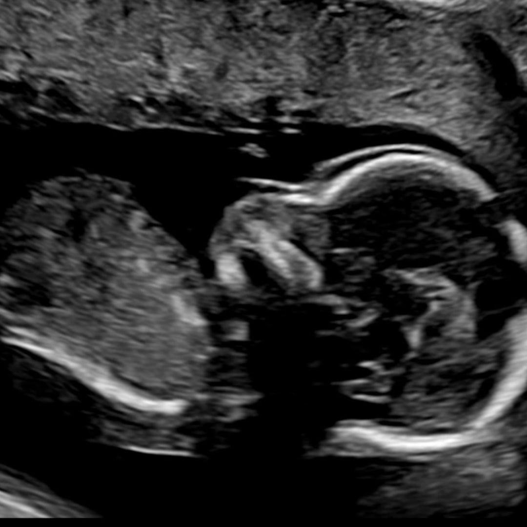 Photo shared by Dakota for their Babylist baby registry.