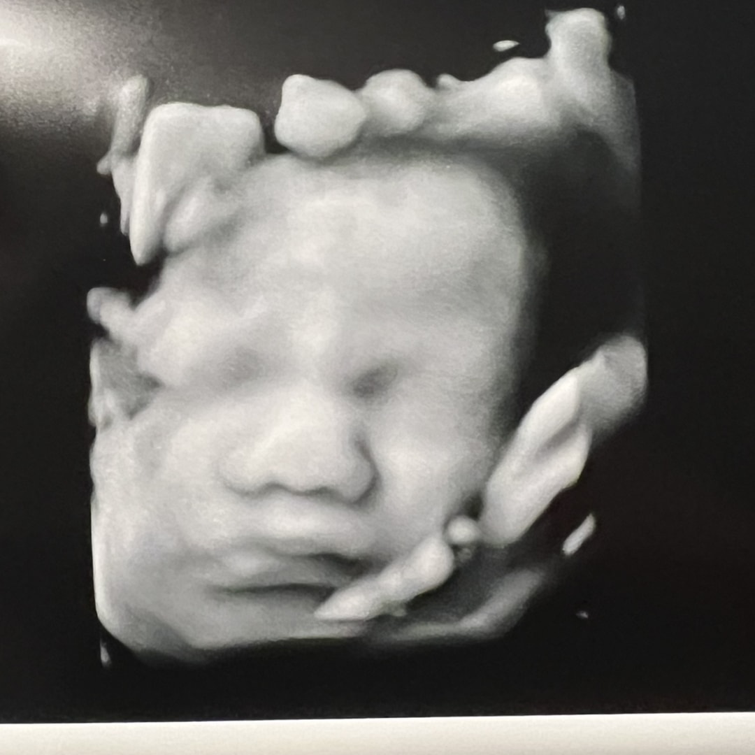 Photo shared by Destiny for their Babylist baby registry.