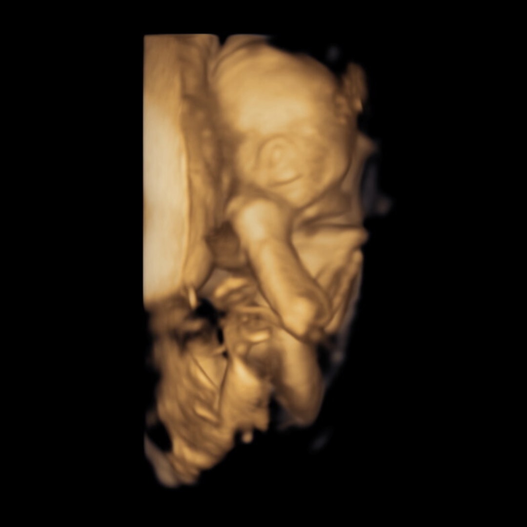 Photo shared by Emily for their Babylist baby registry.