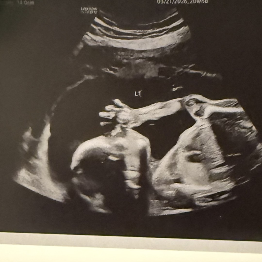 Photo shared by Jenn for their Babylist baby registry.