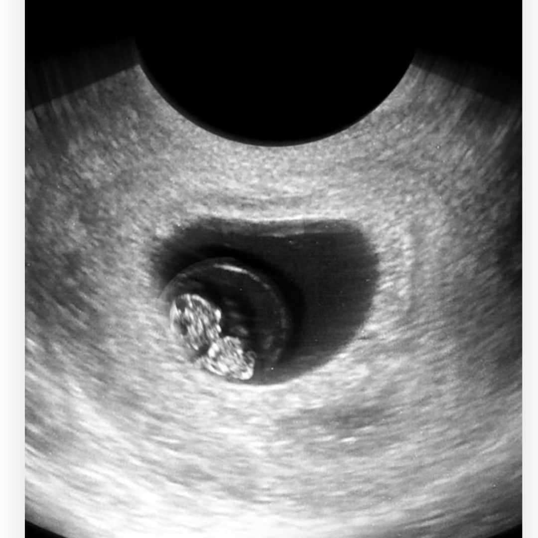 Photo shared by Kaylee for their Babylist baby registry.